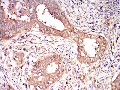 EIF2A / EIF2 Alpha Antibody (aa448-576, clone 3A7B11)