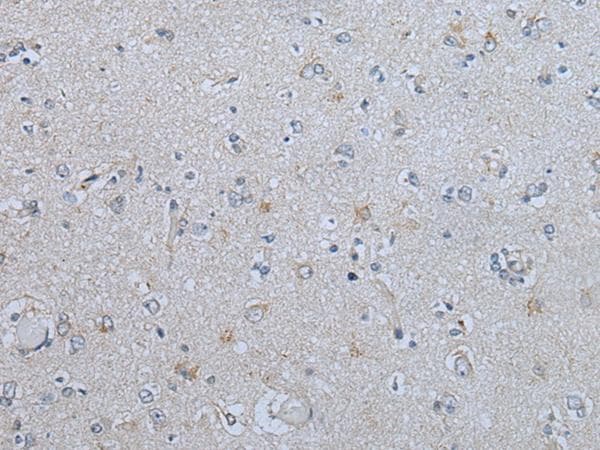 CENPF / CENP-F Antibody