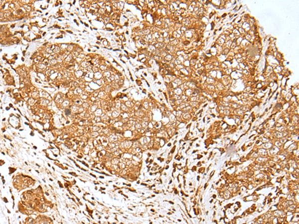 MORF4L1 / MRG15 Antibody