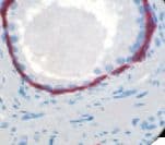 Cytokeratin 5+6 Antibody (clone D5/16B4, Ready-to-Use)