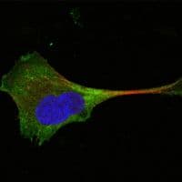 WNT10B Antibody (clone 5A7)