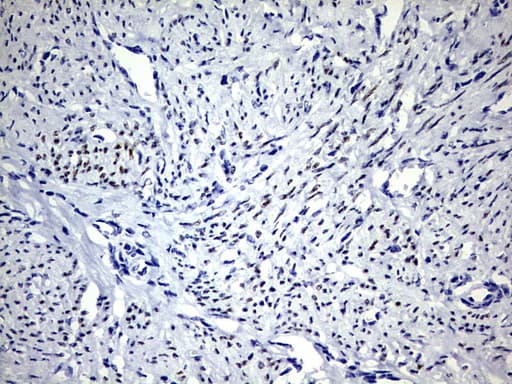 PR / Progesterone Receptor Antibody (aa1-298, clone OTI12D1)