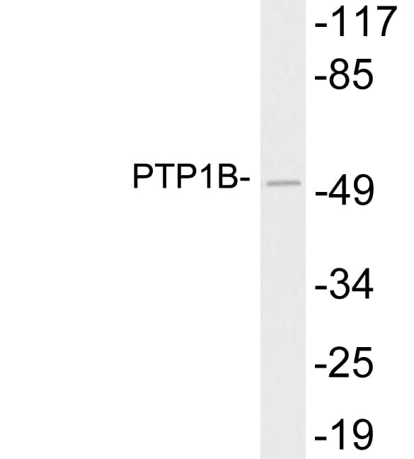 Polyclonal Rabbit anti-Human PTP1B Antibody (aa303-352, WB)