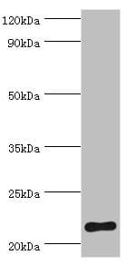 Polyclonal Rabbit anti-Human SOCS2 Antibody (aa1-198, IHC, WB)