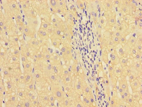 HOXA2 Antibody