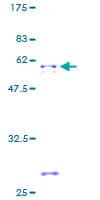 Human ATP4B Protein (Recombinant GST)