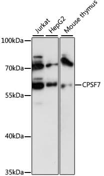 Polyclonal Rabbit anti-Human FLJ12529 / CPSF7 Antibody (WB)