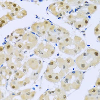 Polyclonal Rabbit anti-Human SMEK1 Antibody (IHC, WB)