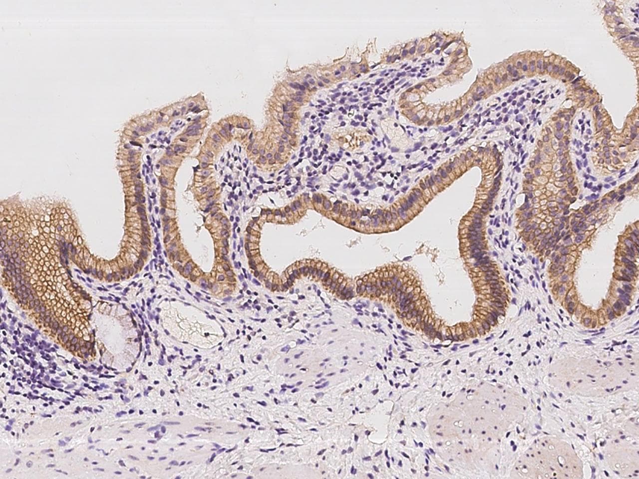 Polyclonal Rabbit anti-Human CCL23 / MIP3 Antibody (IHC)