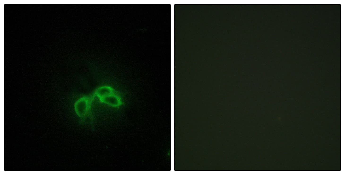BLCAP Antibody (aa38-87)