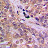 Polyclonal Rabbit anti-Human PRKAA1 / AMPK Alpha 1 Antibody (phospho-Ser496, IHC, IF, WB)