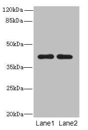 CIPC / KIAA1737 Antibody