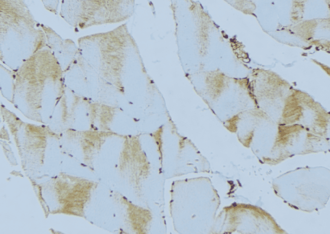 PHPT1 Antibody