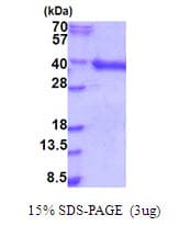Human HDGFL1 Protein (Recombinant His)