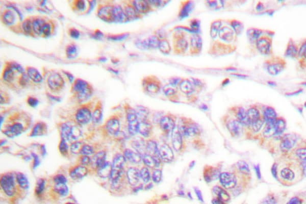 Polyclonal Rabbit anti-Human SYK Antibody (Leu519, IHC, WB)
