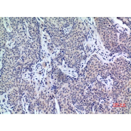 PDGF-D Antibody (311-360 aa, C-terminal)
