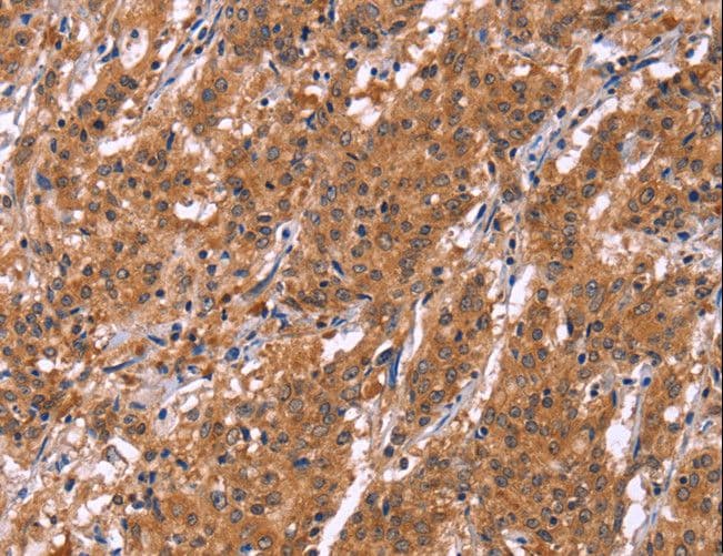 SMARCA3 / HLTF Antibody