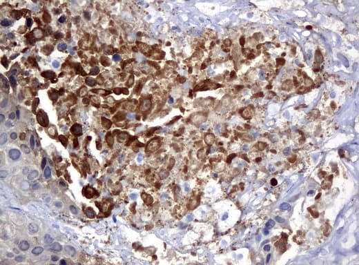 Monoclonal Mouse anti-Human S100P Antibody (clone UMAB24, Carrier-free, IHC, IF, WB)