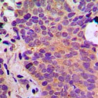 Polyclonal Rabbit anti-Human ADPGK Antibody (Internal, IHC, IF, WB)