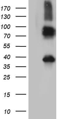 ITM2A Antibody (clone OTI10C11)