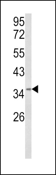 BABAM1 / HSPC142 Antibody (aa116-143)