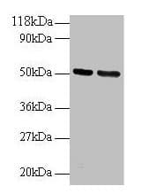 IHC-plus™ GDI2 Antibody