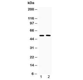 Polyclonal Rabbit anti-Mouse CHRM2 / M2 Antibody (WB)