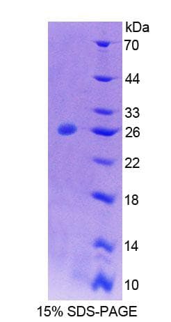 Mouse PTPN21 / PTPD1 Protein (Recombinant His-T7, N-terminus)