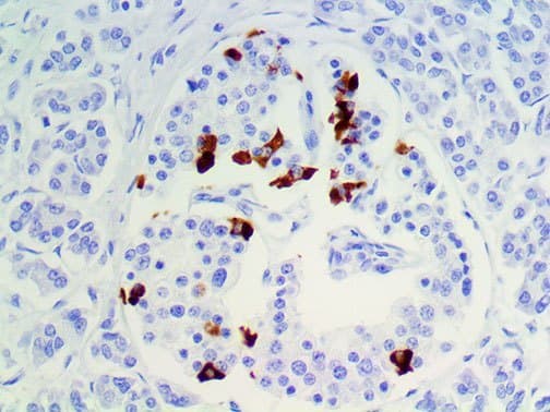 SST / Somatostatin Antibody