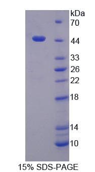 Human GNA11 Protein (Recombinant His-T7)