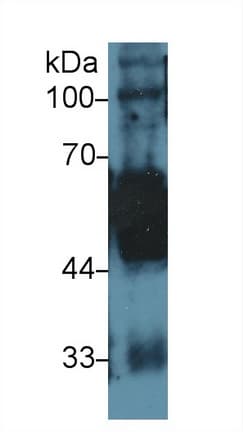 KRT5 / CK5 / Cytokeratin 5 Antibody (aa166-474)