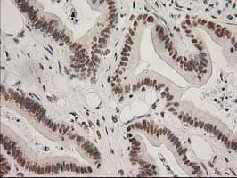 LOX / Lysyl Oxidase Antibody (clone OTI10D11)