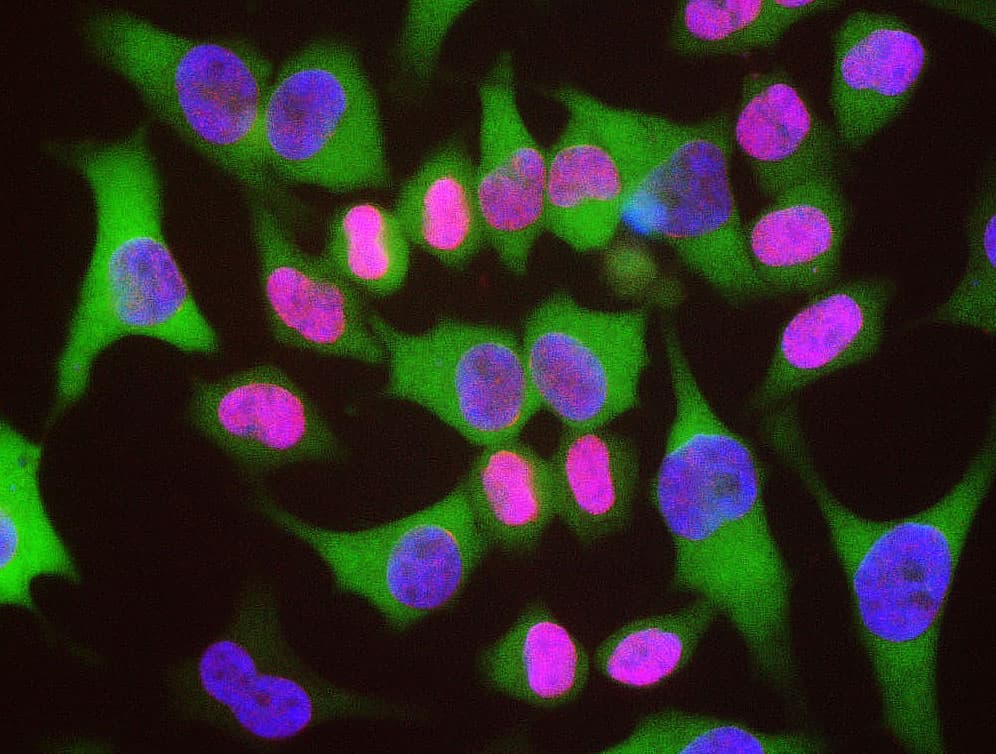 LMNA / Lamin A+C Antibody