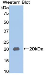 MUC5AC Antibody (aa4944-5030, clone C7, FITC)