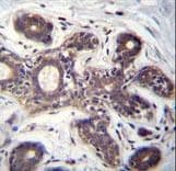 Polyclonal Rabbit anti-Human EIF2B1 Antibody (aa136-163, IHC, WB)