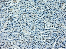 TYRO3 Antibody (clone OTI9B12)