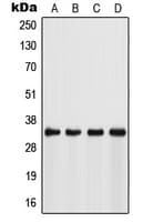 Polyclonal Rabbit anti-Human FSBP Antibody (Internal, WB)