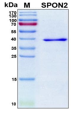 Human SPON2 / MINDIN Protein (Recombinant 6His, N-terminus)