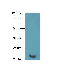 Polyclonal Rabbit anti-Human FATE1 Antibody (WB)