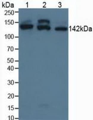 SMC3 / HCAP Antibody (aa994-1181)