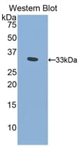 PITRM1 / MP1 Antibody (aa653-926, PE)