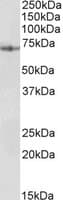 IHC-plus™ PDIA2 Antibody (aa129-141)
