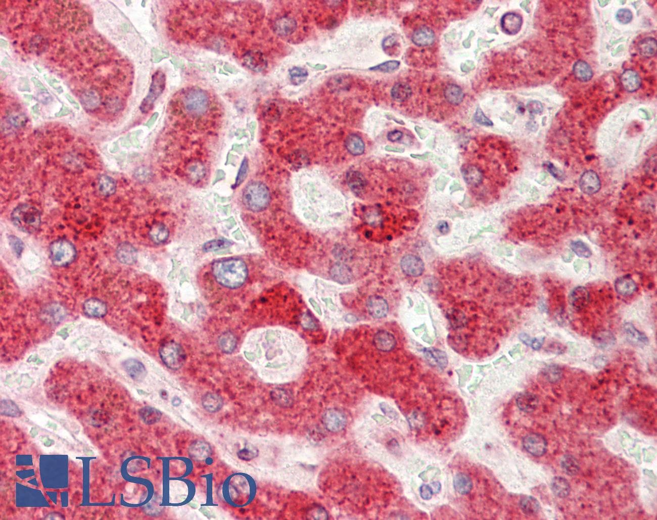 IHC-plus™ Polyclonal Rabbit anti-Human PDIA4 / ERP72 Antibody (aa9-37, IHC, WB)