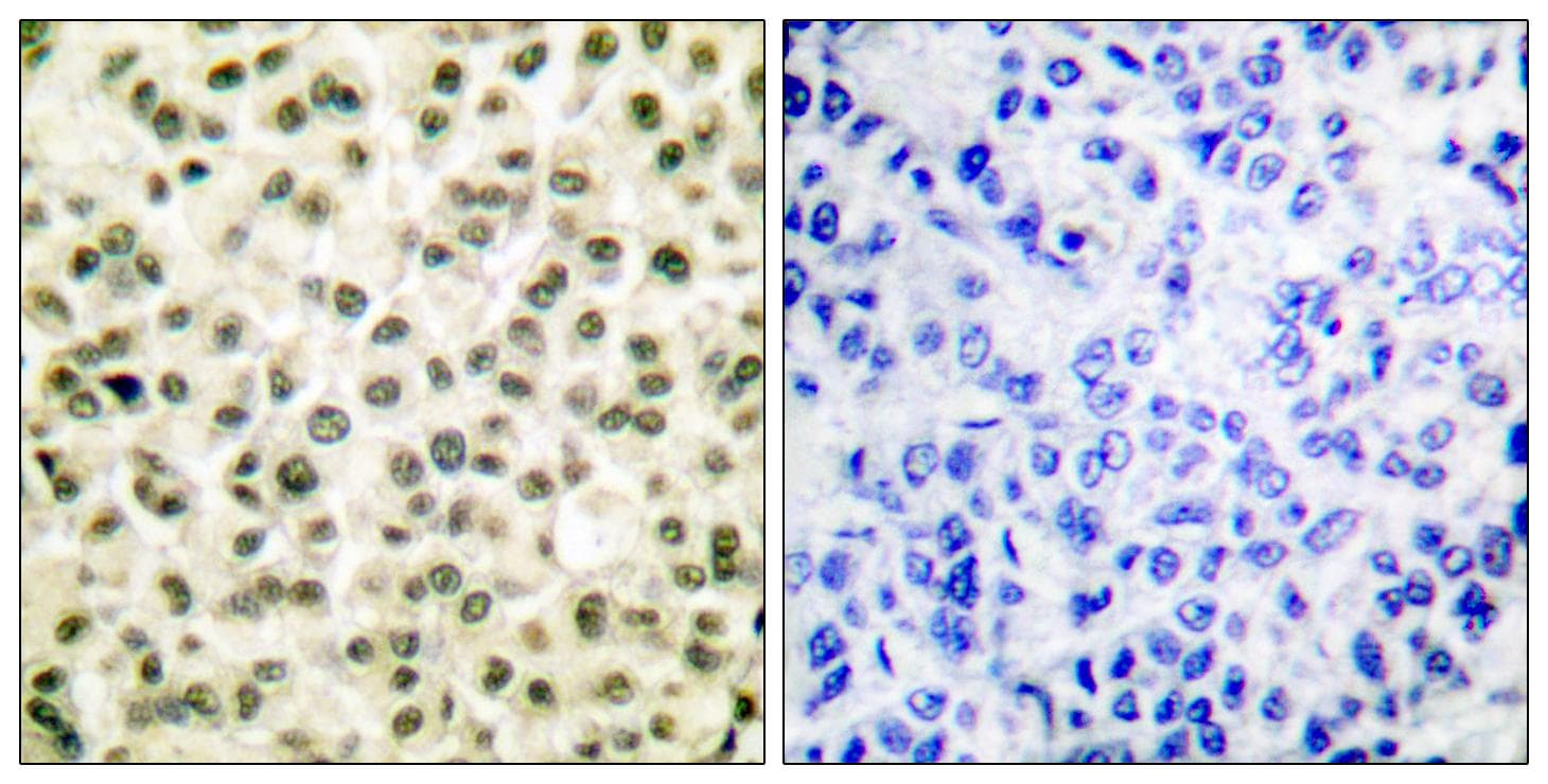 Ku70+Ku80 / XRCC6+XRCC5 Antibody