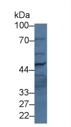 PLB1 Antibody (aa1036-1458, APC)