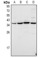 Polyclonal Rabbit anti-Human KCNK7 / K2p7.1 Antibody (WB)