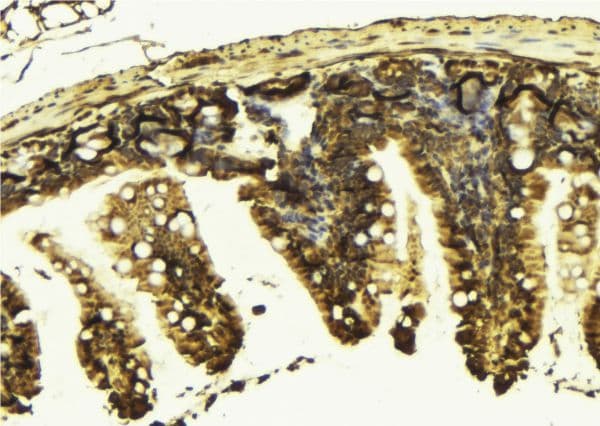 KIF2C / MCAK Antibody