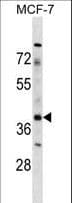 ZAR1 Antibody (aa108-137)