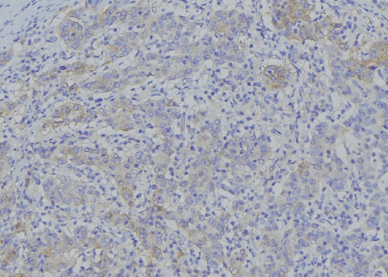 SLC25A4 / ANT Antibody