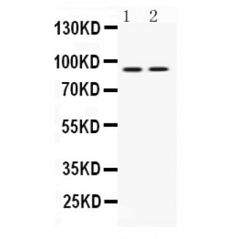 UHRF1 Antibody (aa14-51)